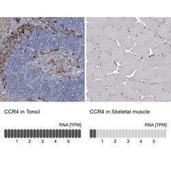 CCR4 Antibody, Novus Biologicals 25 &mu;L; Unlabeled:Antibodies, Polyclonal